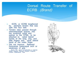 Dorsal Route Transfer of 
ECRB (Brand) 
 ECRL or ECRB lengthened 
by plantaris tendon that was 
split into four tails 
 Tendon slips passed through 
intermetacarpal spaces, into 
the lumbrical canal and 
palmar to the DTML, to be 
attached to radial lateral 
bands of the long, ring, and 
little fingers and ulnar lateral 
band of the index finger 
 Did not improve flattened 
transverse metacarpal arch or 
weakness of grip 
Brand PW: Hand reconstruction in leprosy . 
British Surgical Practice: Surgical Progress , 
London: Butterworth; 1954 
 