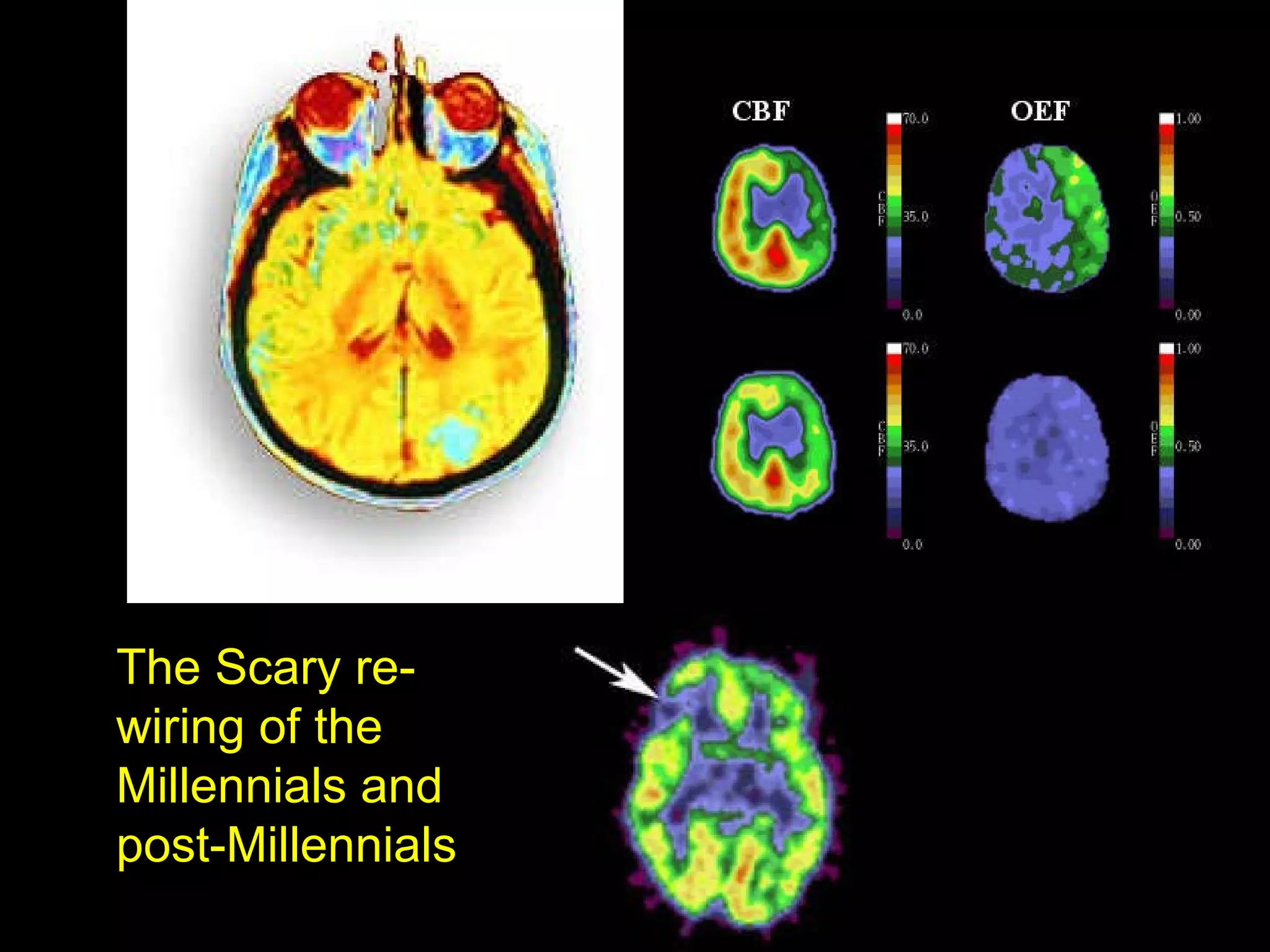 The Scary re-wiring of the Millennials and post-Millennials  