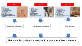 Localized Redeness Comprehensive Guide to Catheter-Related Bloodstream Infections (CRBSI ...