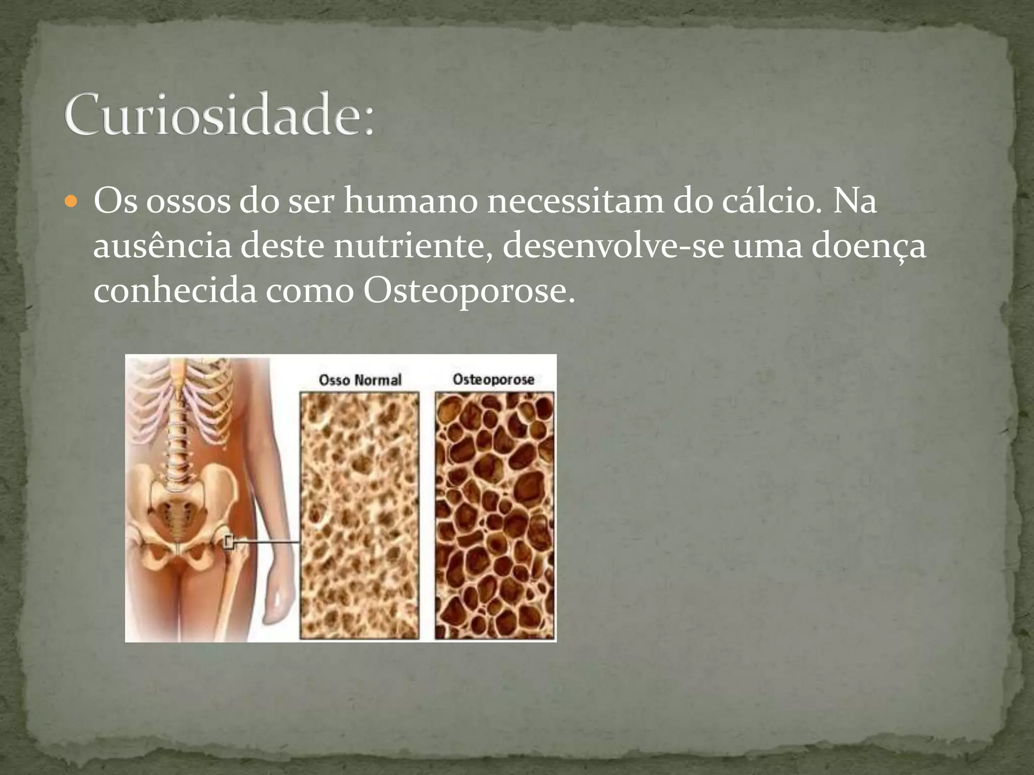  Os ossos do ser humano necessitam do cálcio. Na
ausência deste nutriente, desenvolve-se uma doença
conhecida como Osteoporose.