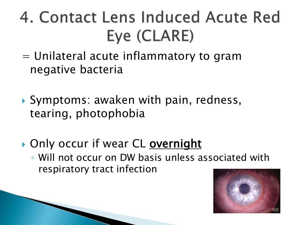 Complications of Contact Lenses