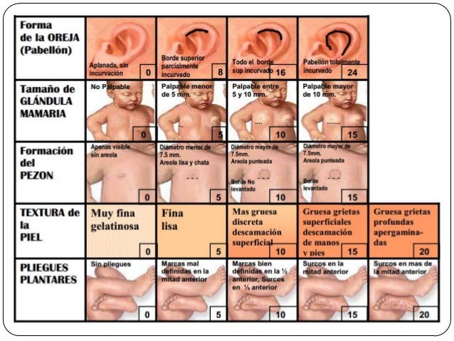 Resultado de imagen para capurro escala