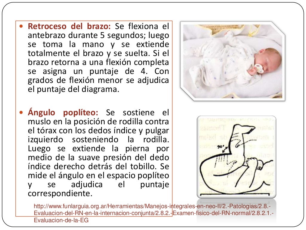 Cálculo de la edad gestacional según ballard y capurro Cálculo de la edad gestacional según ballard y capurro