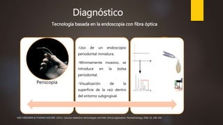Diagnóstico
Periscopía
-Uso de un endoscopio
periodontal miniatura.
-Mínimamente invasivo, se
introduce en la bolsa
periodontal.
-Visualización de la
superficie de la raíz dentro
del entorno subgingival.
Autofluorescencia
Tecnología basada en la endoscopia con fibra óptica
GRIT MEISSNER & THOMAS KOCHER. (2011). Calculus-detection technologies and their clinical application. Periodontology 2000, 55, 189-204.
 