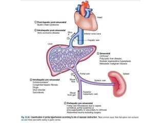 chronic liver disease | PPTX