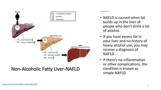 Non-Alcoholic Fatty Liver-NAFLD
• NAFLD is caused when fat
builds up in the liver of
people who don’t drink a lot
of alcohol.
• If you have excess fat in
your liver and no history of
heavy alcohol use, you may
receive a diagnosis of
NAFLD.
• If there’s no inflammation
or other complications, the
condition is known as
simple NAFLD.
https://doi.org/10.3390/metabo10070283
15
 