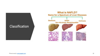 Classification
www.goggle.com
 
