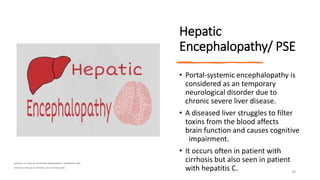 Hepatic
Encephalopathy/ PSE
• Portal-systemic encephalopathy is
considered as an temporary
neurological disorder due to
chronic severe liver disease.
• A diseased liver struggles to filter
toxins from the blood affects
brain function and causes cognitive
impairment.
• It occurs often in patient with
cirrhosis but also seen in patient
with hepatitis C.
MANUAL OF CLINICAL NUTRITION MANAGEMENT, MORRISON: 2001
KRAUSE'S FOOD & NUTRITION (12TH EDITION) 2008
28
 