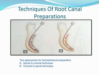 Techniques Of Root Canal
Preparations
Two approaches for biomechanical preparation
A. Apical to coronal technique
B Coronal to apical technique
 