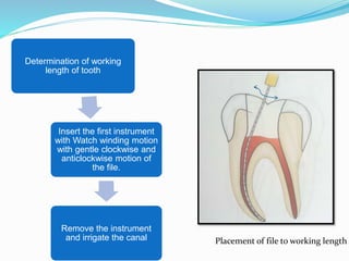 Determination of working
length of tooth
Insert the first instrument
with Watch winding motion
with gentle clockwise and
anticlockwise motion of
the file.
Remove the instrument
and irrigate the canal Placement of file to working length
 
