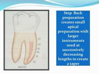 Step Back
preparation
creates small
apical
preparation with
larger
instruments
used at
successively
decreasing
lengths to create
a taper
 