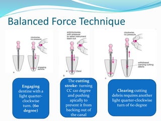 Balanced Force Technique
Engaging
dentine with a
light quarter-
clockwise
turn. (60
degree)
The cutting
stroke- turning
CC 120 degree
and pushing
apically to
prevent it from
backing out of
the canal
Clearing cutting
debris requires another
light quarter-clockwise
turn of 60 degree
 