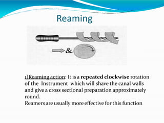 Reaming
1)Reaming action: It is a repeated clockwise rotation
of the Instrument which will shave the canal walls
and give a cross sectional preparation approximately
round.
Reamersare usually moreeffective for this function
 