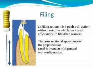 Filing
2) Filing action: It is a push pull action
without rotation which has a great
efficiency with files than reamers.
Thecross sectional appearanceof
theprepared root
canal is irregularwith general
oval configuration.
 