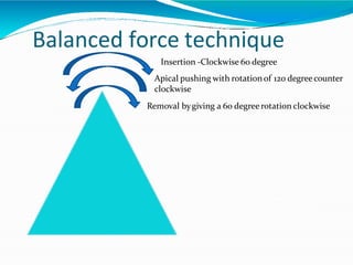 Balanced force technique
Insertion -Clockwise 60 degree
Apical pushing with rotationof 120 degreecounter
clockwise
Removal bygiving a 60 degree rotation clockwise
 