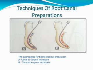 Techniques Of Root Canal
Preparations
Two approaches for biomechanical preparation
A. Apical to coronal technique
B Coronal to apical technique
 