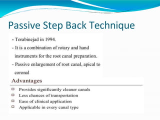 Passive Step Back Technique
 