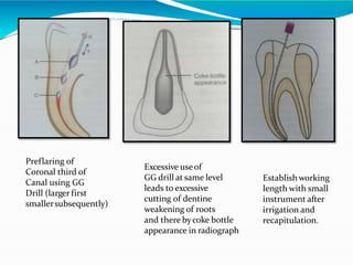 Preflaring of
Coronal third of
Canal using GG
Drill (larger first
smallersubsequently)
Excessive useof
GG drill at same level
leads to excessive
cutting of dentine
weakening of roots
and there bycoke bottle
appearance in radiograph
Establish working
length with small
instrument after
irrigation and
recapitulation.
 