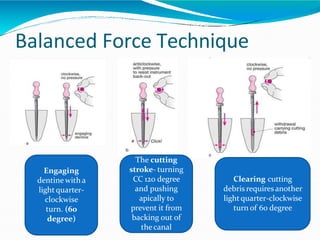 Balanced Force Technique
Engaging
dentine with a
lightquarter-
clockwise
turn. (60
degree)
The cutting
stroke- turning
CC 120 degree
and pushing
apically to
prevent it from
backing out of
thecanal
Clearing cutting
debris requires another
lightquarter-clockwise
turn of 60 degree
 
