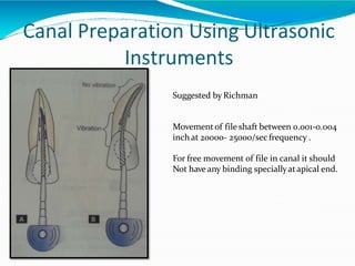 Canal Preparation Using Ultrasonic
Instruments
Suggested by Richman
Movementof file shaft between 0.001-0.004
inch at 20000- 25000/sec frequency .
For free movement of file in canal it should
Not have any binding speciallyatapical end.
 