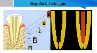 22
Step Back Technique
 