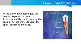 Crown Down Preparation
In the crown down technique, the
dentist prepares the canal
from crown of the tooth, shaping the
canal as he/she moves towards the
apical portion of the canal
 