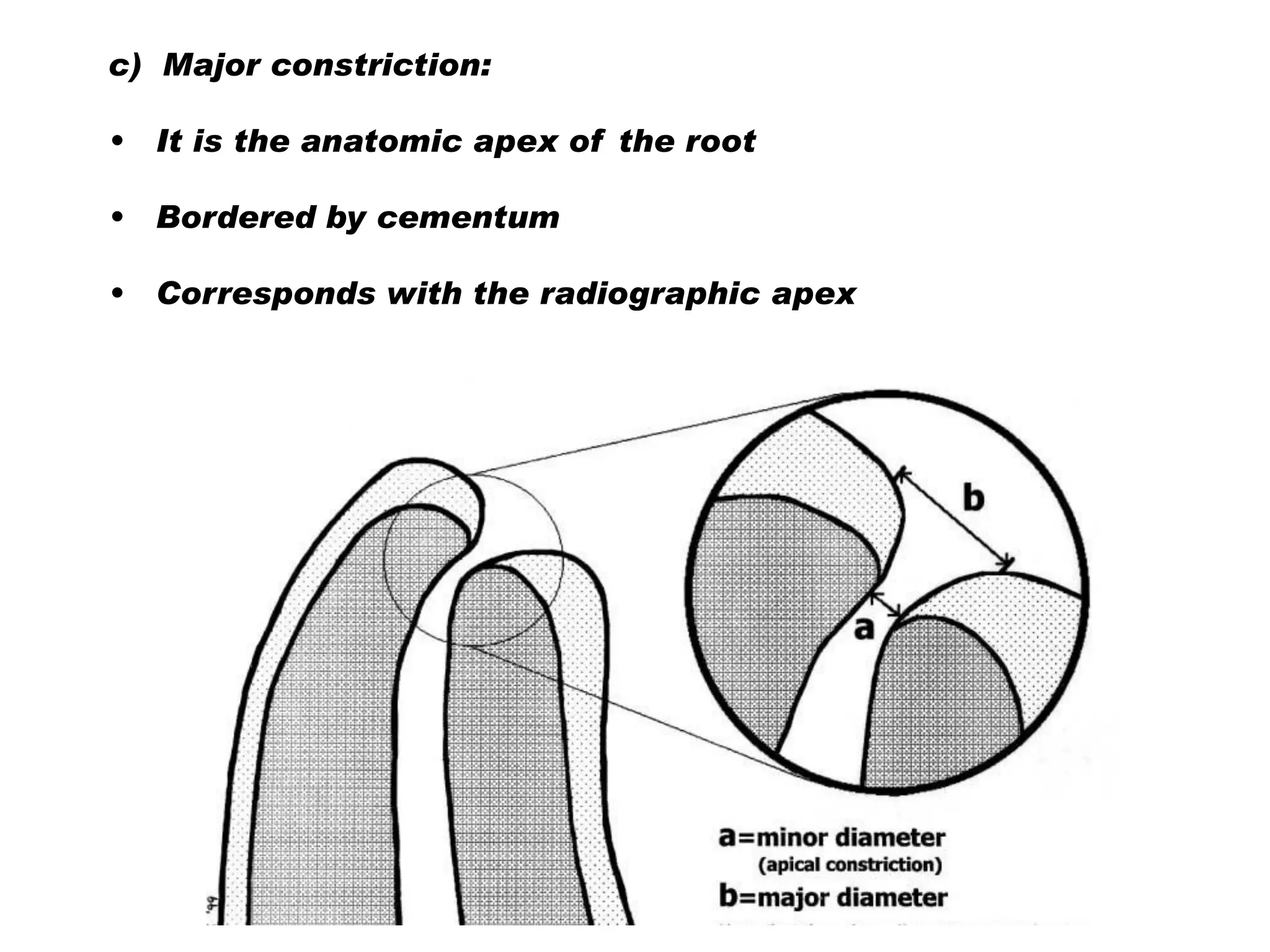 c) Major constriction:
•

It is the anatomic apex of the root

•

Bordered by cementum

•

Corresponds with the radiographic apex

 
