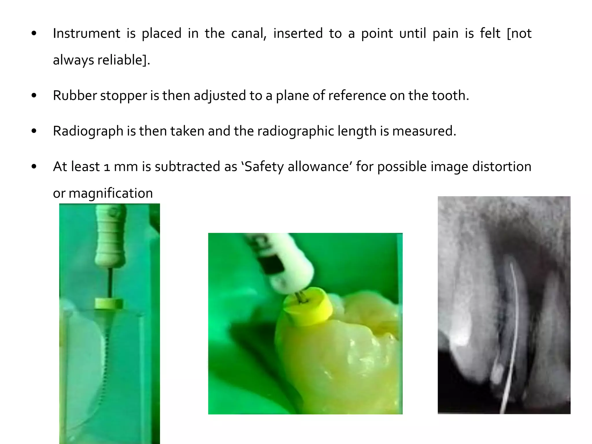 •

Instrument is placed in the canal, inserted to a point until pain is felt [not

always reliable].
•

Rubber stopper is then adjusted to a plane of reference on the tooth.

•

Radiograph is then taken and the radiographic length is measured.

•

At least 1 mm is subtracted as ‘Safety allowance’ for possible image distortion
or magnification

 