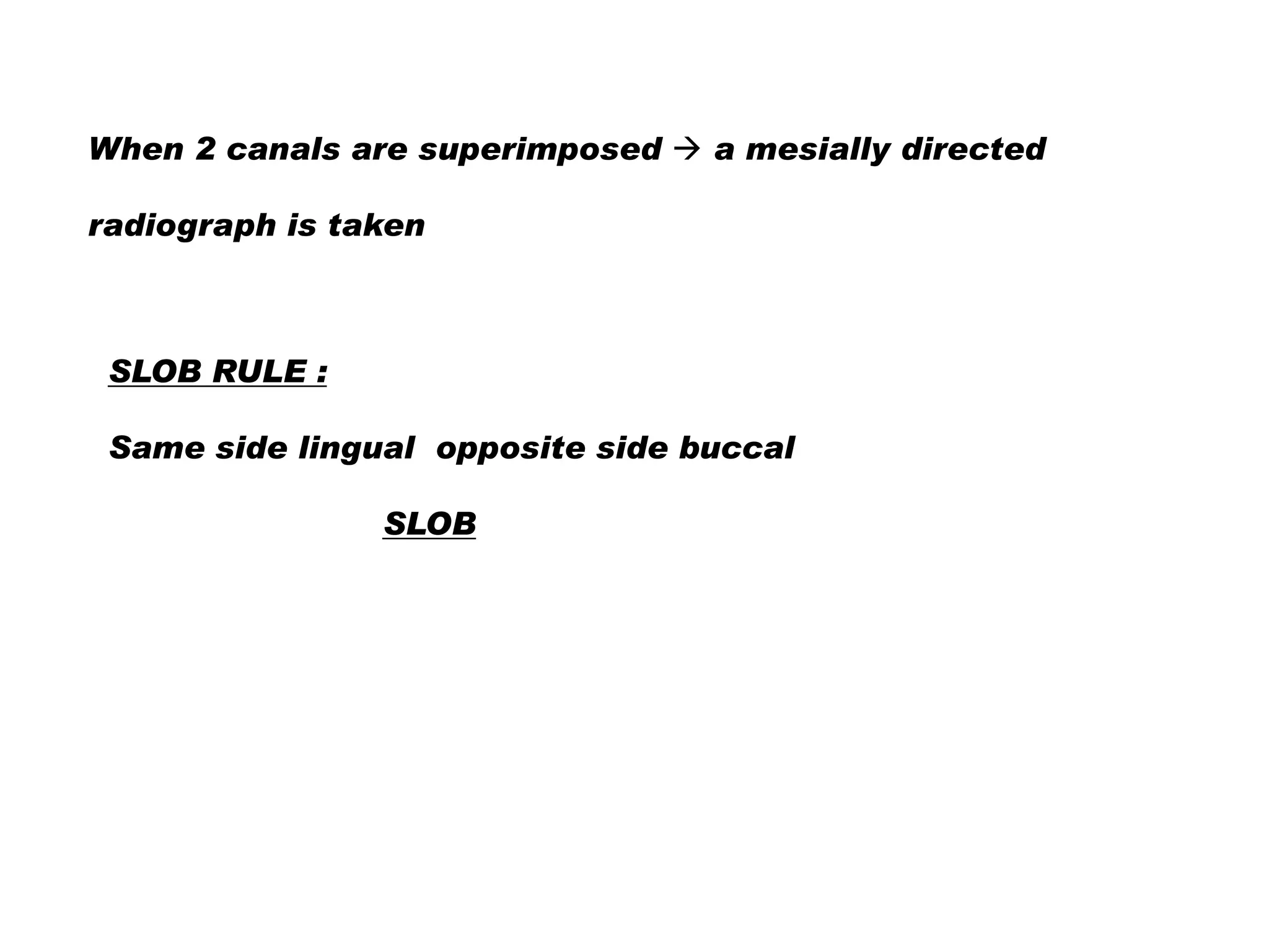 When 2 canals are superimposed  a mesially directed
radiograph is taken

SLOB RULE :
Same side lingual opposite side buccal

SLOB

 