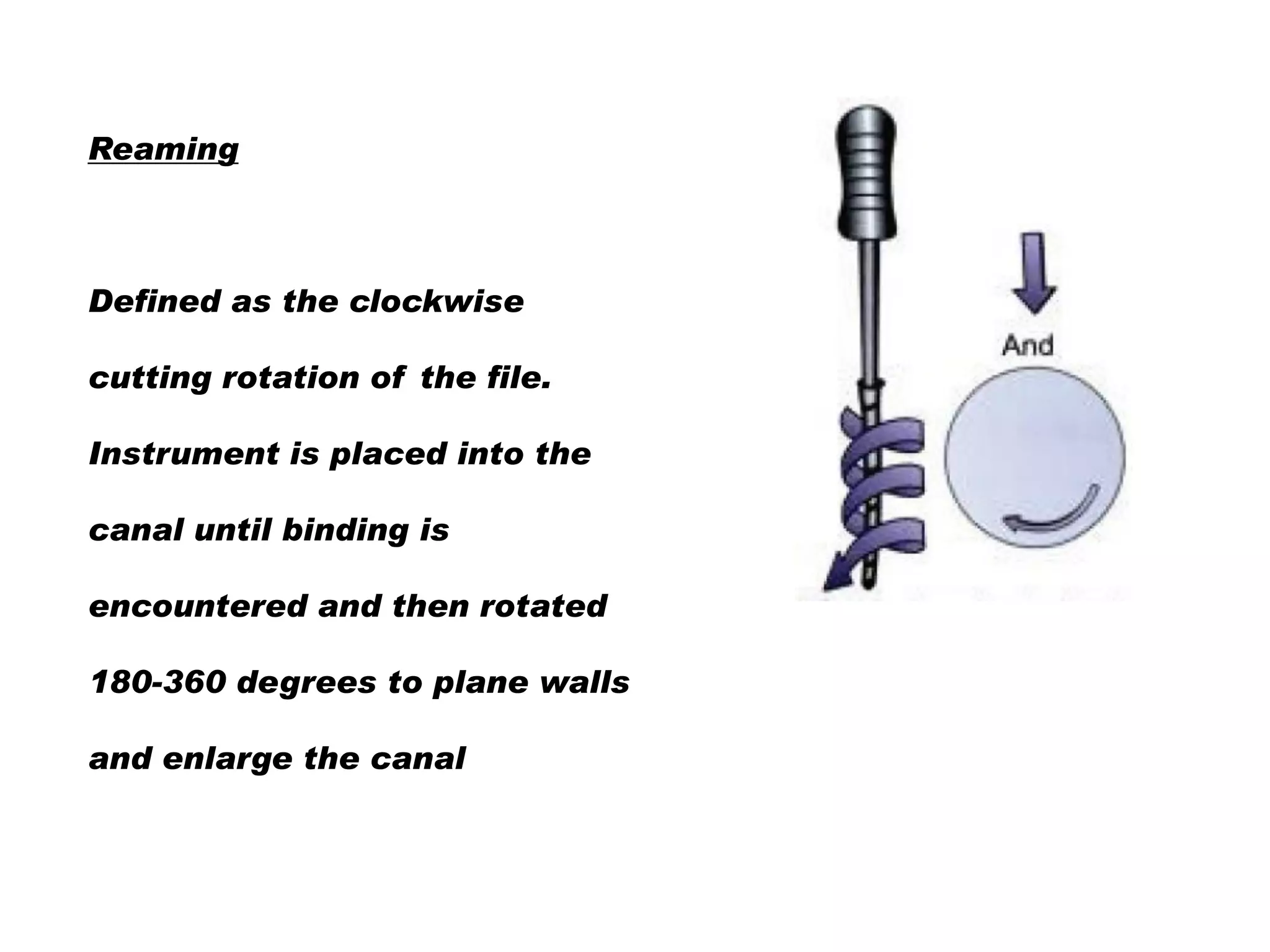 Reaming

Defined as the clockwise

cutting rotation of the file.
Instrument is placed into the
canal until binding is

encountered and then rotated
180-360 degrees to plane walls
and enlarge the canal

 