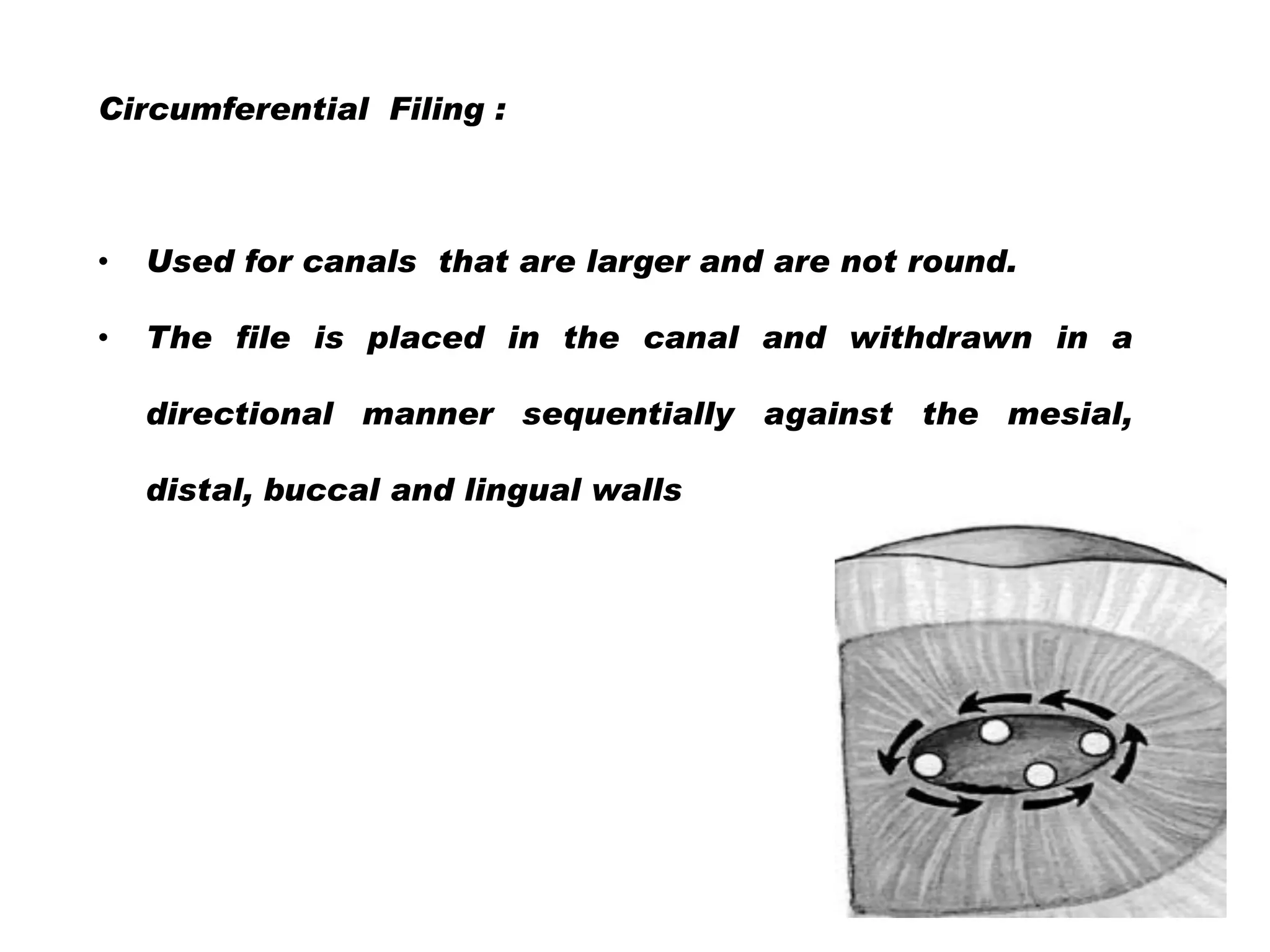 Circumferential Filing :

•

Used for canals that are larger and are not round.

•

The file is placed in the canal and withdrawn in a
directional manner sequentially against the mesial,
distal, buccal and lingual walls

 