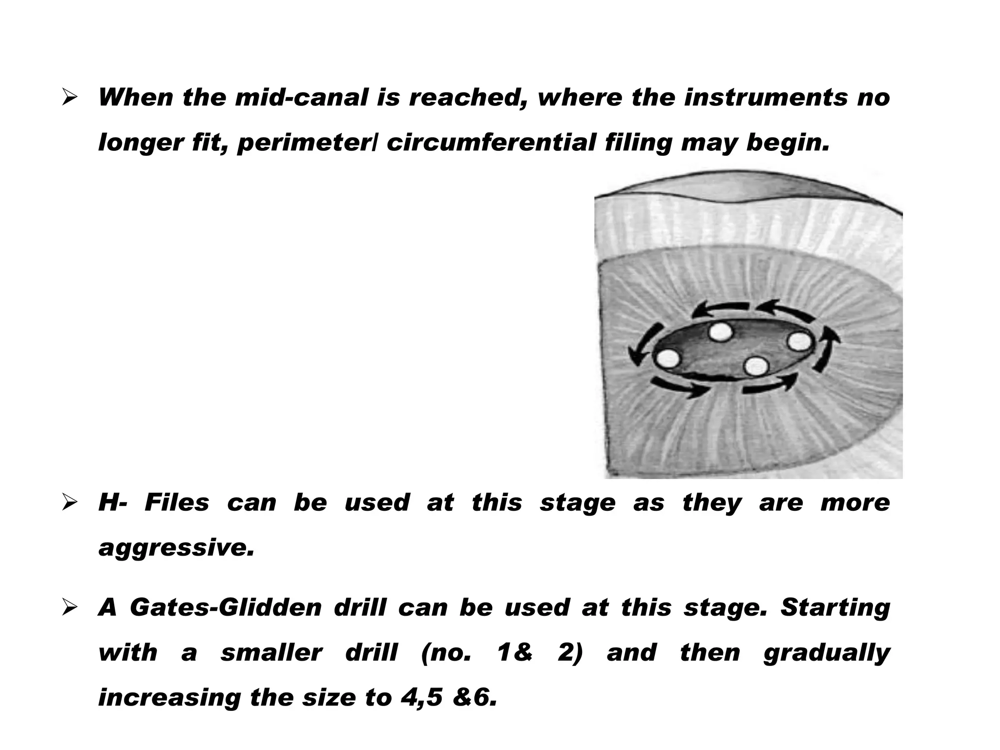  When the mid-canal is reached, where the instruments no
longer fit, perimeter/ circumferential filing may begin.

 H- Files can be used at this stage as they are more
aggressive.

 A Gates-Glidden drill can be used at this stage. Starting
with a smaller drill (no. 1& 2) and then gradually
increasing the size to 4,5 &6.

 