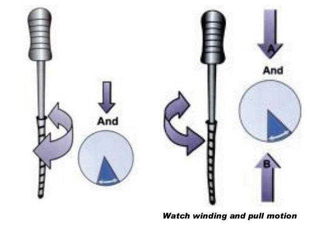 Watch winding motion Clearance