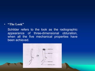 • “The Look”
Schilder refers to the look as the radiographic
appearance of three-dimensional obturation,
when all the five mechanical properties have
been achieved.
 