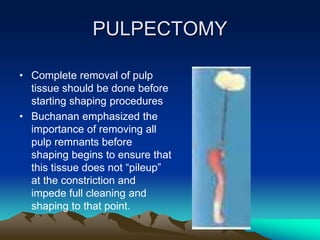 PULPECTOMY
• Complete removal of pulp
tissue should be done before
starting shaping procedures
• Buchanan emphasized the
importance of removing all
pulp remnants before
shaping begins to ensure that
this tissue does not “pileup”
at the constriction and
impede full cleaning and
shaping to that point.
 