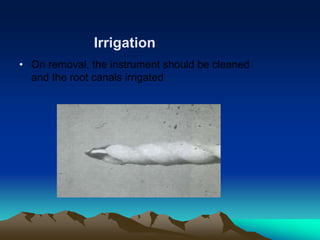 • On removal, the instrument should be cleaned
and the root canals irrigated
Irrigation
 