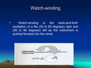 Watch-winding
• Watch-winding is the back-and-forth
oscillation of a file (30 to 60 degrees) right and
(30 to 60 degrees) left as the instrument is
pushed forward into the canal.
 