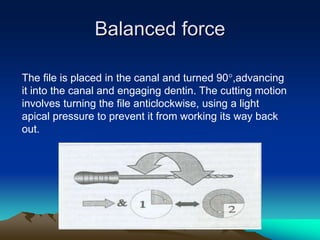 Balanced force
The file is placed in the canal and turned 90,advancing
it into the canal and engaging dentin. The cutting motion
involves turning the file anticlockwise, using a light
apical pressure to prevent it from working its way back
out.
 