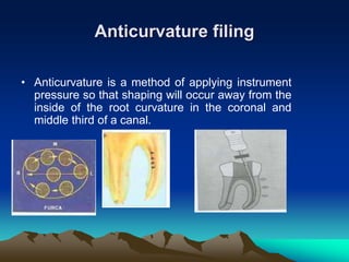 Anticurvature filing
• Anticurvature is a method of applying instrument
pressure so that shaping will occur away from the
inside of the root curvature in the coronal and
middle third of a canal.
 