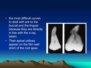 • the most difficult curves
to deal with are to the
buccal and the lingual
because they are directly
in line with the x-ray
beam.
• Their apical orifices
appear on the film well
short of the root apex.
 