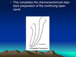 • This completes the chemomechanical step-
back preparation of the continuing taper
canal.
 