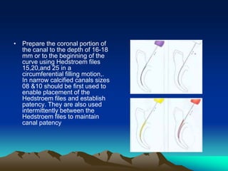 • Prepare the coronal portion of
the canal to the depth of 16-18
mm or to the beginning of the
curve using Hedstroem files
15,20,and 25 in a
circumferential filling motion,.
In narrow calcified canals sizes
08 &10 should be first used to
enable placement of the
Hedstroem files and establish
patency. They are also used
intermittently between the
Hedstroem files to maintain
canal patency
 