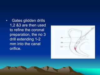 • Gates glidden drills
1,2 &3 are then used
to refine the coronal
preparation, the no 3
drill extending 1-2
mm into the canal
orifice.
 