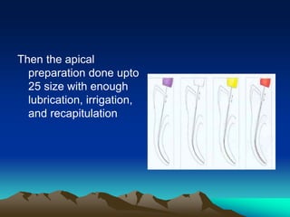Then the apical
preparation done upto
25 size with enough
lubrication, irrigation,
and recapitulation
 