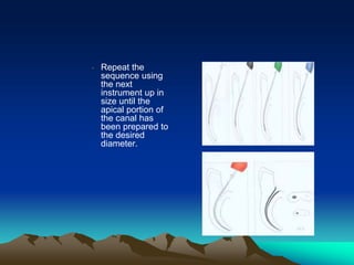 • Repeat the
sequence using
the next
instrument up in
size until the
apical portion of
the canal has
been prepared to
the desired
diameter.
 