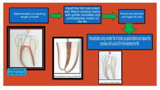 Cleaning and shaping of Root canal system | PPTX