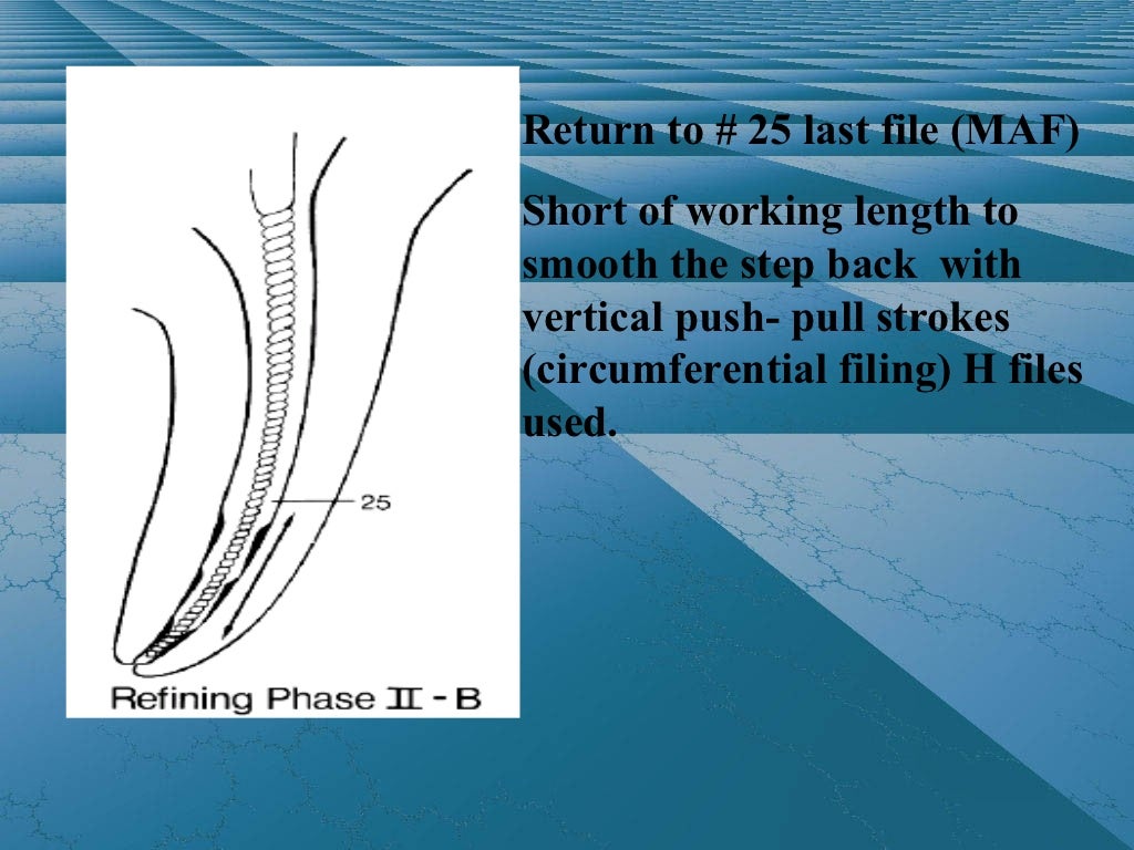 Cleaning and shaping the root canal system