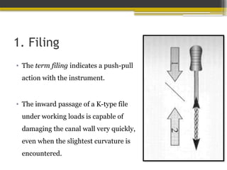 1. Filing
• The term filing indicates a push-pull
action with the instrument.
• The inward passage of a K-type file
under working loads is capable of
damaging the canal wall very quickly,
even when the slightest curvature is
encountered.
 