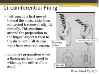 Circumferential Filing
• Instrument is first moved
toward the buccal side, then
reinserted & removed slightly
mesially. This continues
around the preparation to
the lingual aspect & then to
the distal untill all dentin
walls have received rasping.
• Enhances preparation when
a flaring method is used by
widening the orifice of the
canal.
6th ed. Pg 166/7
Weine
Reaming
action
Keyhole
Circumferential filing
 