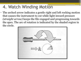 4. Watch Winding Motion
• The arched arrow indicates a gentle right and left rocking motion
that causes the instrument to cut while light inward pressure
(straight arrow) keeps the file engaged and progressing towards
the apex. The arc of rotation is indicated by the shaded region in
the circle.
 
